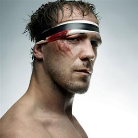 肖像摄影师Denis Rouvre  《Sortie de Match》(球场出口)  Broken face（受伤的脸））