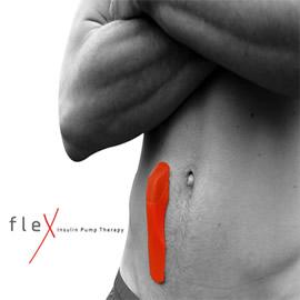 来自设计师 Ellaluna Taylor 的水蛭胰岛素泵 Flex insulin pump