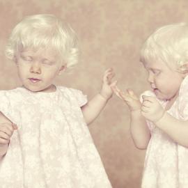 关爱白化病 摄影系列