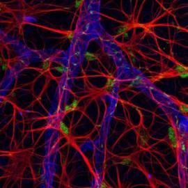 从精子到大肠杆菌 奥林巴斯大赛作品赏