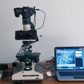 显微镜下的蝴蝶翅膀