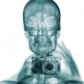 你见过X光自拍照吗？