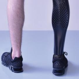 3D打印假肢