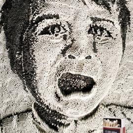 Michou‘y儿童基金会：被惨痛烧死的宝宝们