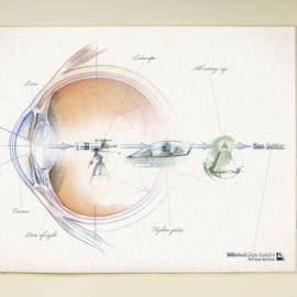 米切尔眼科中心