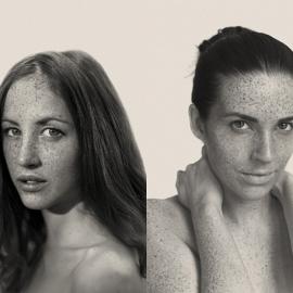 Reto Caduff肖像摄影作品：雀斑